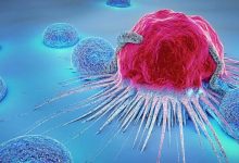 Photo of Cancer, bagaimana menyikapinya ?